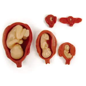 Uterus/Fetus Model Set (5)